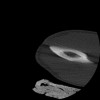 SPORK, NICO - 22.03.1976 - 02.08.2022 - CT obere Extremität - 17:51:17
